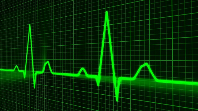heart beating