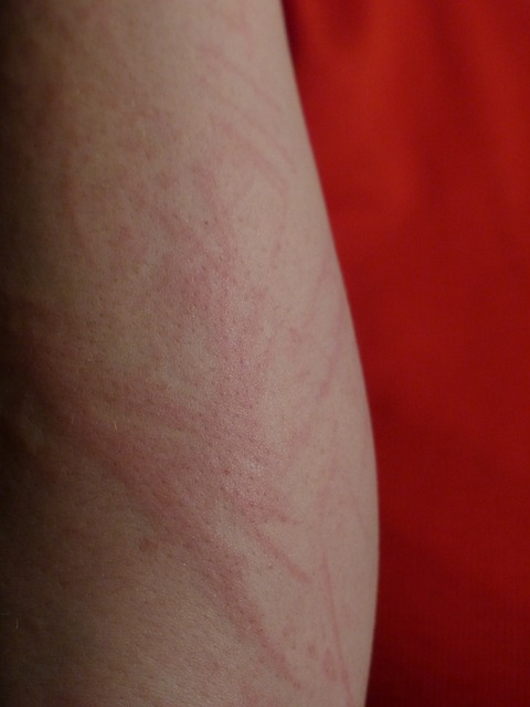 red rash
