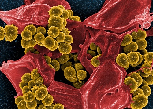 Increases Your Immunity To Infections