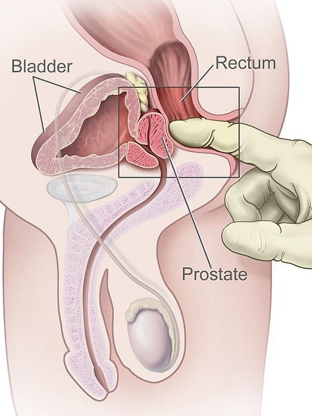 locate prostate gland